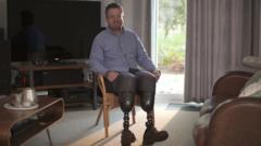 British surgeon who had his legs removed  accused of fraud
